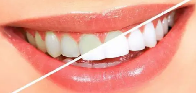 如(rú)何更好(hǎo)去(qù)選擇合适的(de)口腔護理(lǐ)産品？