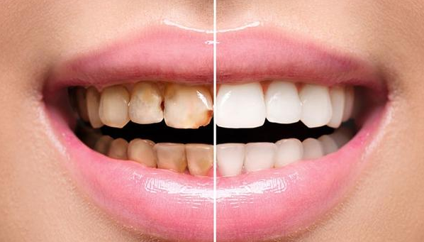 關乎口腔健康的(de)事(shì)兒(ér)，每一(yī)件(jiàn)都(dōu)很(hěn)重要(yào)！